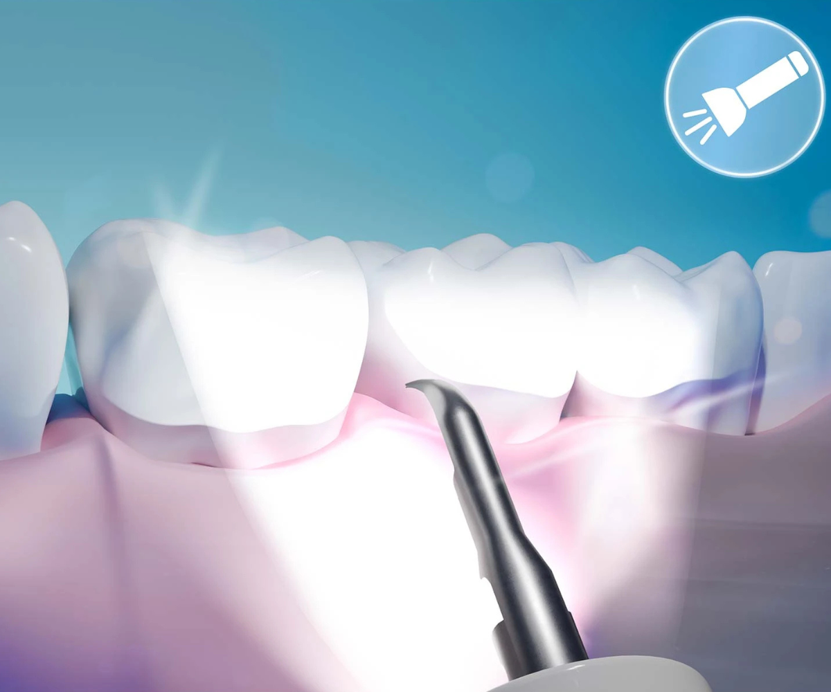 Berdsen BD-250 hambaskaler ultraheli tehnoloogia ja USB-C laadimisega